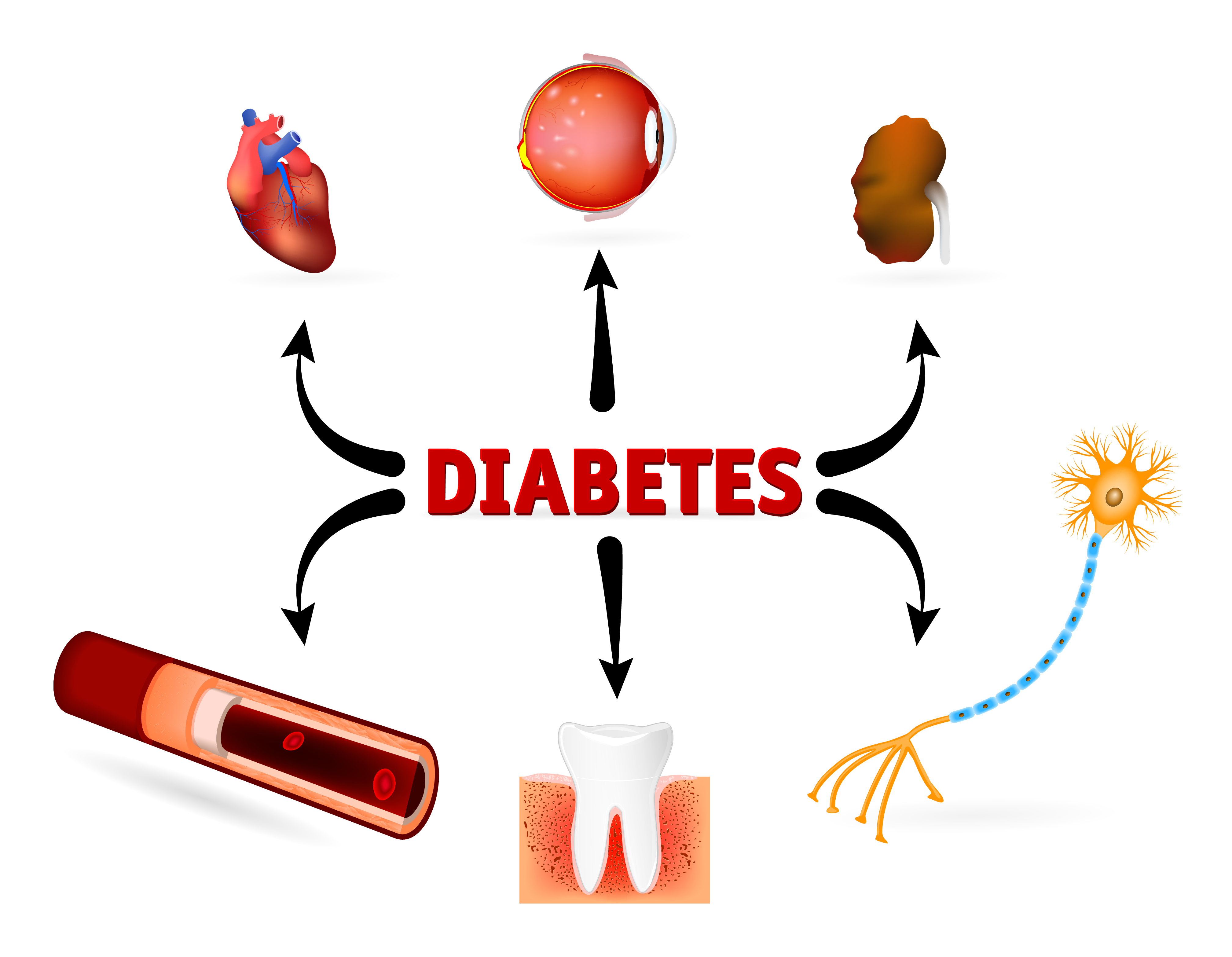 What is Diabetes Mellitus